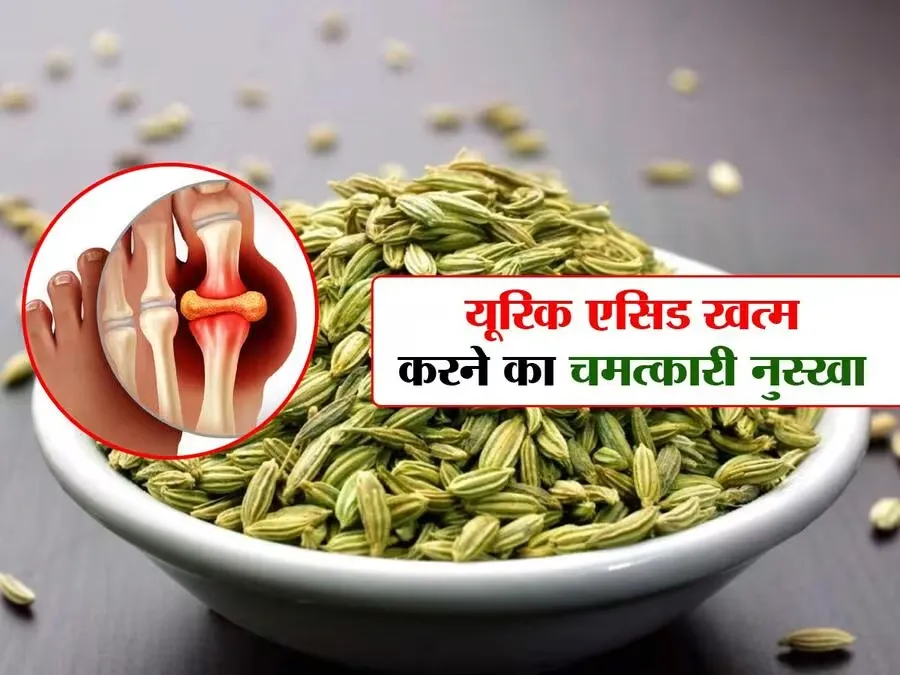 यूरिक एसिड की समस्या में 'रामबाण' है ये उपाय, अपनाते ही दूर हो जाएगी ये भी समस्याएं 1 Fennel Seeds For Uric Acid